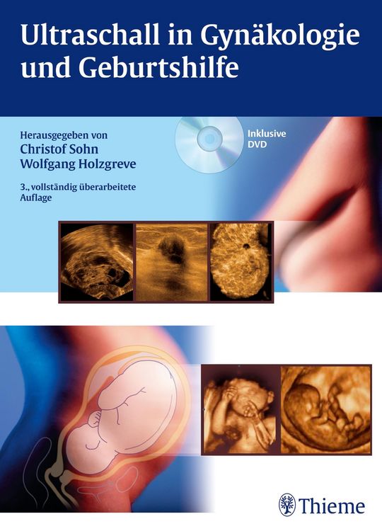 Produktbild: Ultraschall in Gyn&auml;kologie und Geburtshilfe
