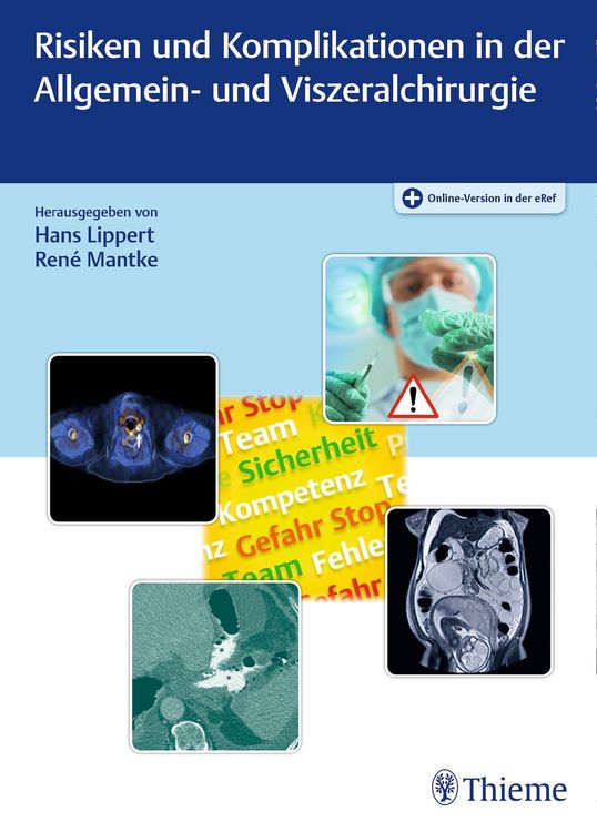 Produktbild: Risiken und Komplikationen in der Allgemein- und Viszeralchirurgie