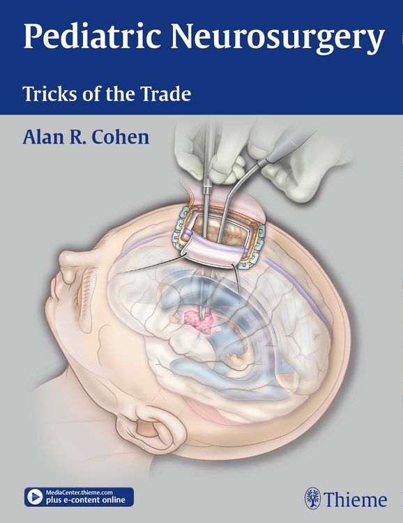 Produktbild: Pediatric Neurosurgery: Tricks of the Trade