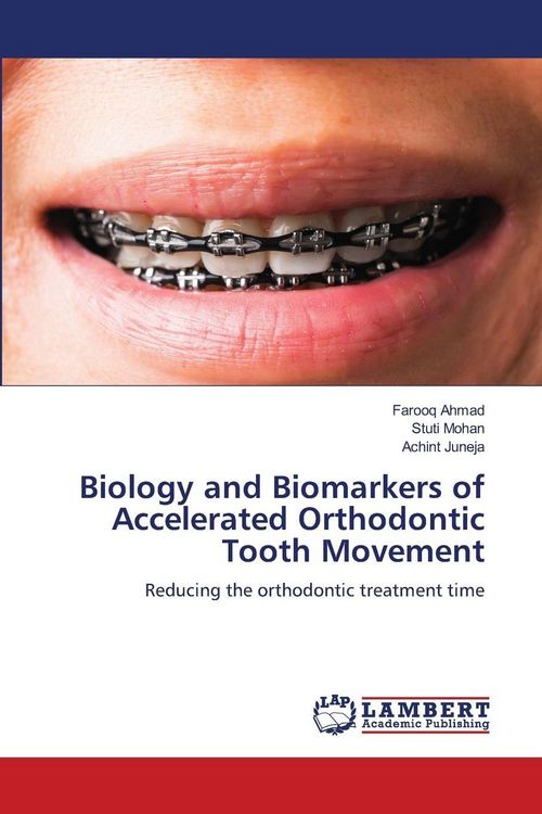 Produktbild: Biology and Biomarkers of Accelerated Orthodontic Tooth Movement