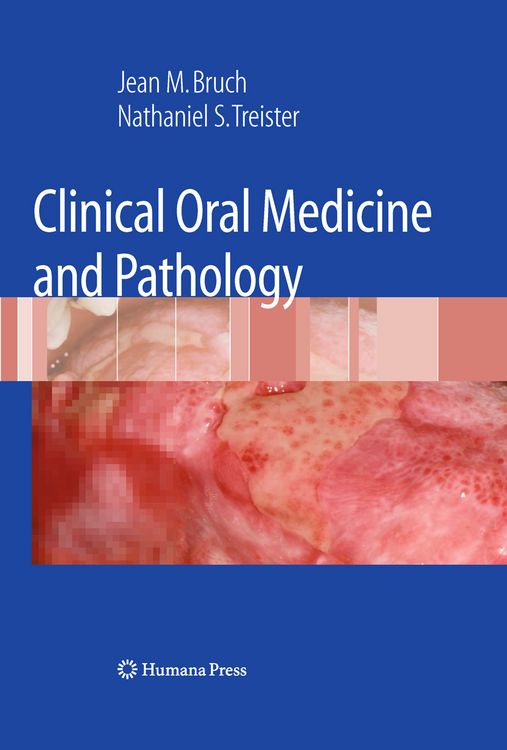 Produktbild: Clinical Oral Medicine and Pathology