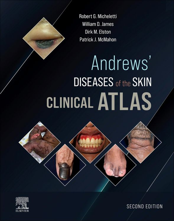 Produktbild: Andrews' Diseases of the Skin Clinical Atlas,E-Book