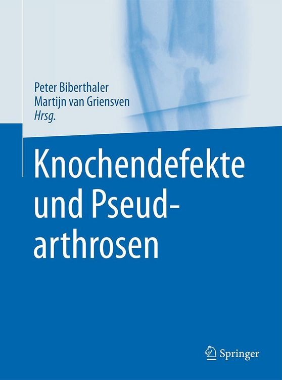 Produktbild: Knochendefekte und Pseudarthrosen