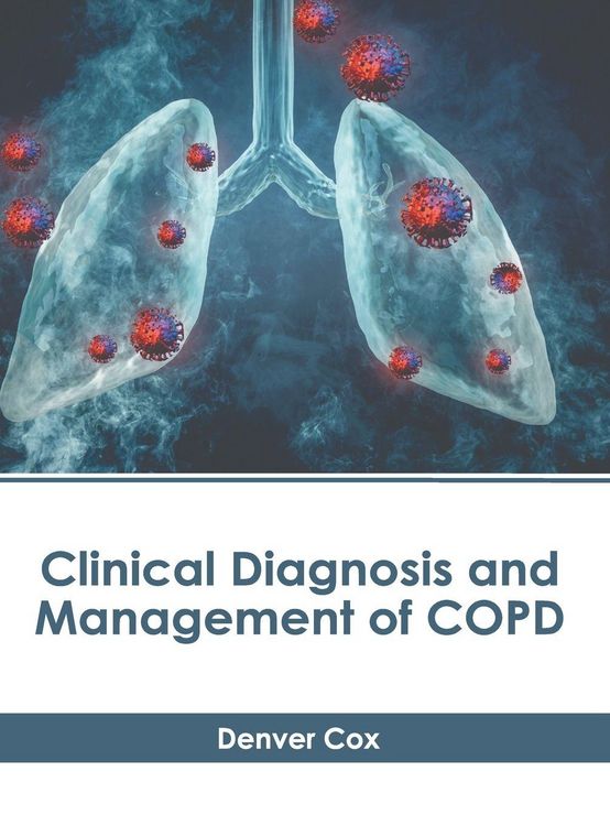 Produktbild: Clinical Diagnosis and Management of Copd
