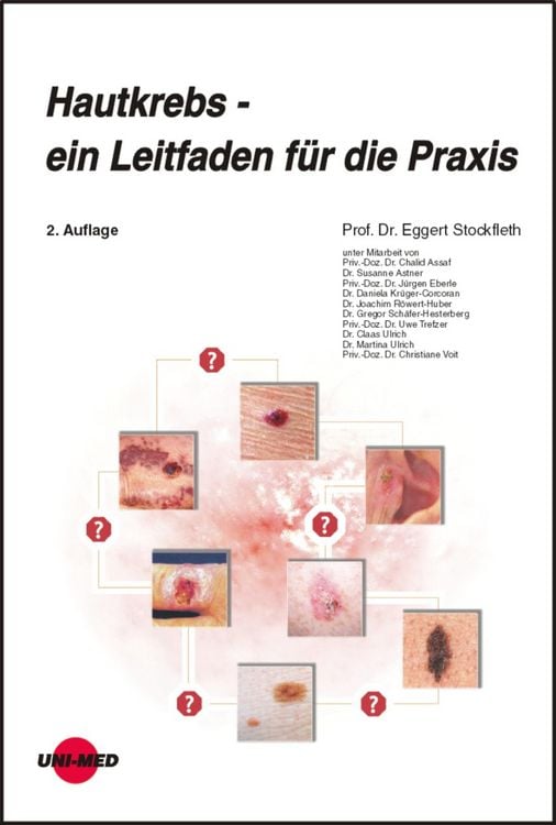 Produktbild: Hautkrebs - ein Leitfaden f&uuml;r die Praxis