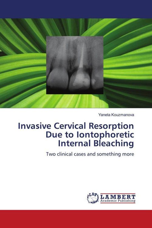 Produktbild: Invasive Cervical Resorption Due to Iontophoretic Internal Bleaching