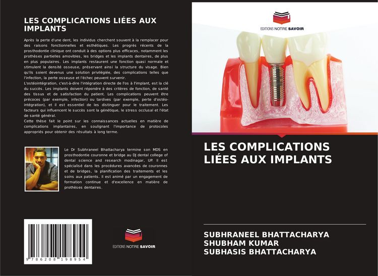 Produktbild: Les Complications Li&eacute;es Aux Implants