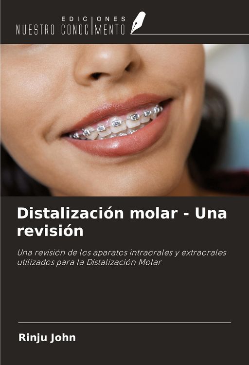 Produktbild: Distalizaci&oacute;n molar - Una revisi&oacute;n