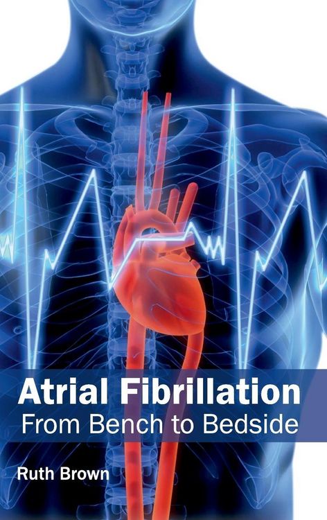 Produktbild: Atrial Fibrillation
