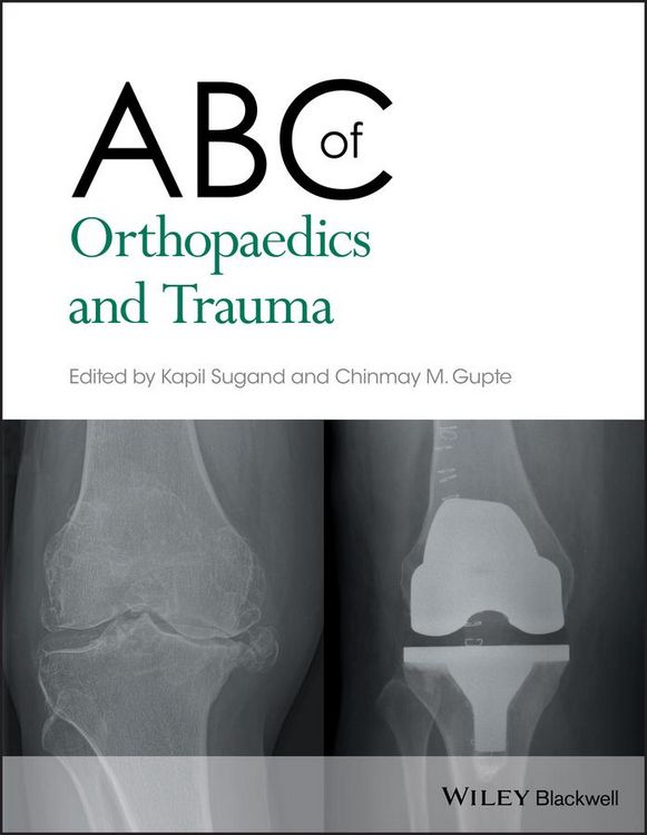 Produktbild: ABC of Orthopaedics and Trauma
