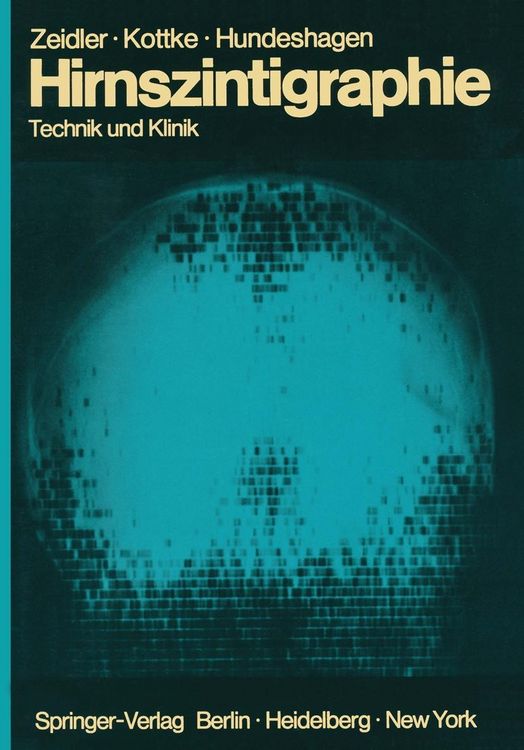Produktbild: Hirnszintigraphie