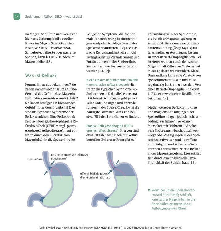Produktbild: K&ouml;stlich essen Reflux und Sodbrennen
