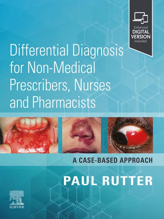Produktbild: Differential Diagnosis for Non-medical Prescribers, Nurses and Pharmacists: A Case-Based Approach - E-BOOK