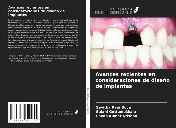 Produktbild: Avances recientes en consideraciones de dise&ntilde;o de implantes