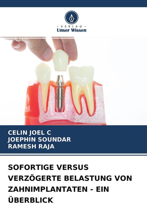 Produktbild: Sofortige Versus Verz&ouml;gerte Belastung von Zahnimplantaten - ein &Uuml;berblick