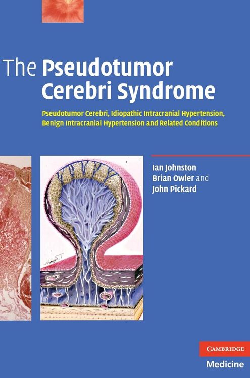 Produktbild: The Pseudotumor Cerebri Syndrome