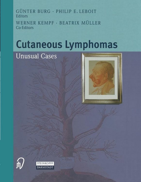Produktbild: Cutaneous Lymphomas