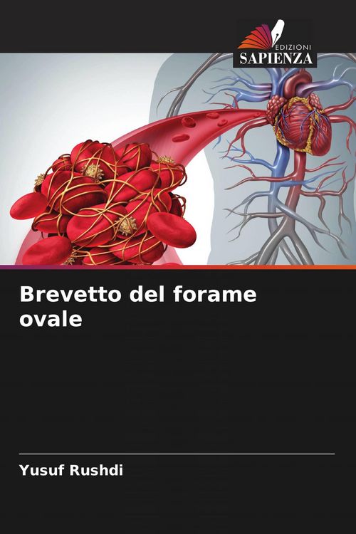 Produktbild: Brevetto del forame ovale