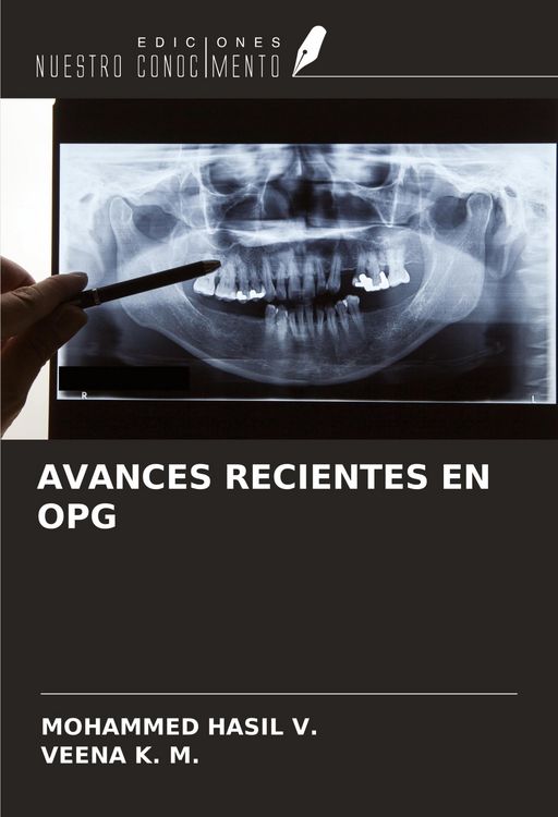 Produktbild: Avances Recientes En Opg