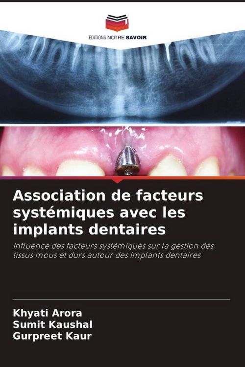 Produktbild: Association de facteurs syst&eacute;miques avec les implants dentaires