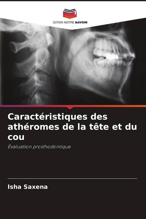 Produktbild: Caract&eacute;ristiques des ath&eacute;romes de la t&ecirc;te et du cou