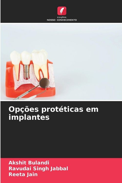 Produktbild: Op&ccedil;&otilde;es prot&eacute;ticas em implantes