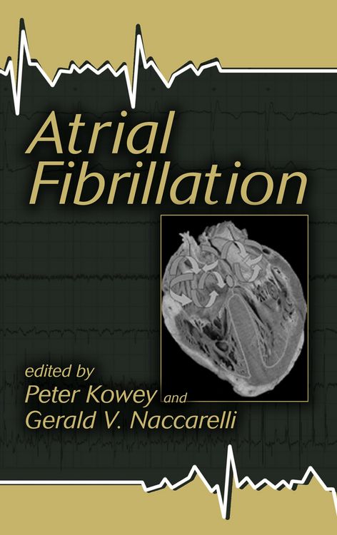 Produktbild: Atrial Fibrillation