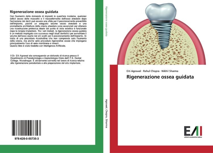 Produktbild: Rigenerazione ossea guidata