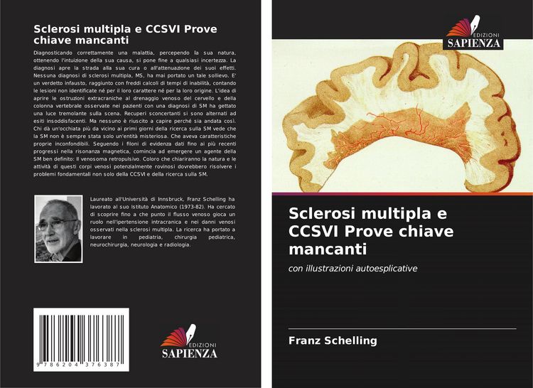 Produktbild: Sclerosi multipla e CCSVI Prove chiave mancanti