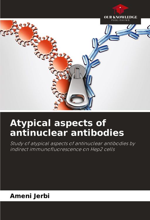 Produktbild: Atypical aspects of antinuclear antibodies