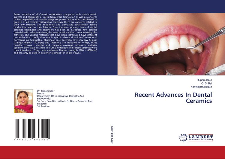 Produktbild: Recent Advances In Dental Ceramics