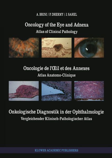 Produktbild: Oncology of the Eye and Adnexa / Oncologie de l&rsquo;&OElig;il et des Annexes / Onkologische Diagnostik in der Ophthalmologie