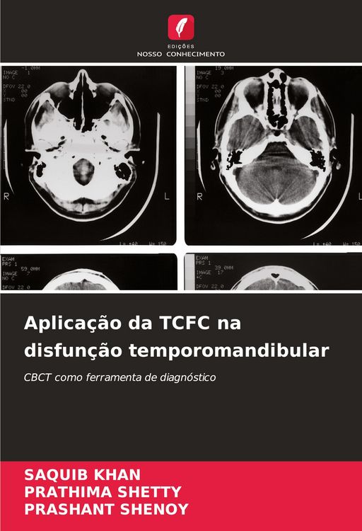 Produktbild: Aplica&ccedil;&atilde;o da TCFC na disfun&ccedil;&atilde;o temporomandibular