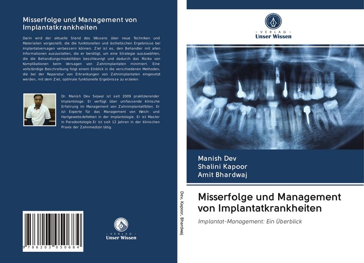 Produktbild: Misserfolge und Management von Implantatkrankheiten