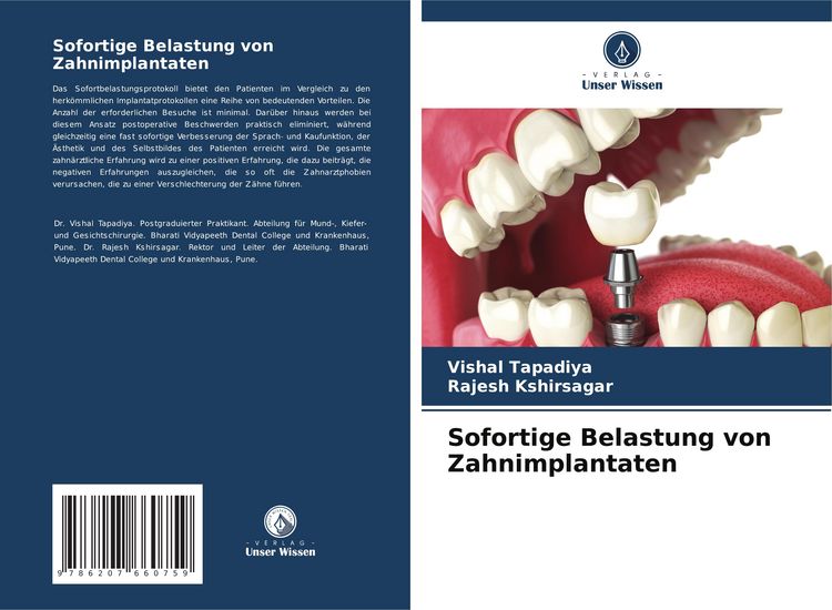 Produktbild: Sofortige Belastung von Zahnimplantaten