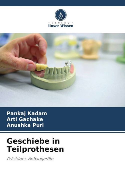 Produktbild: Geschiebe in Teilprothesen