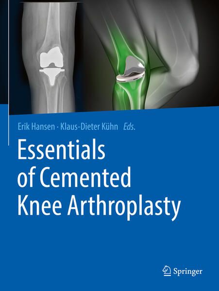 Produktbild: Essentials of Cemented Knee Arthroplasty