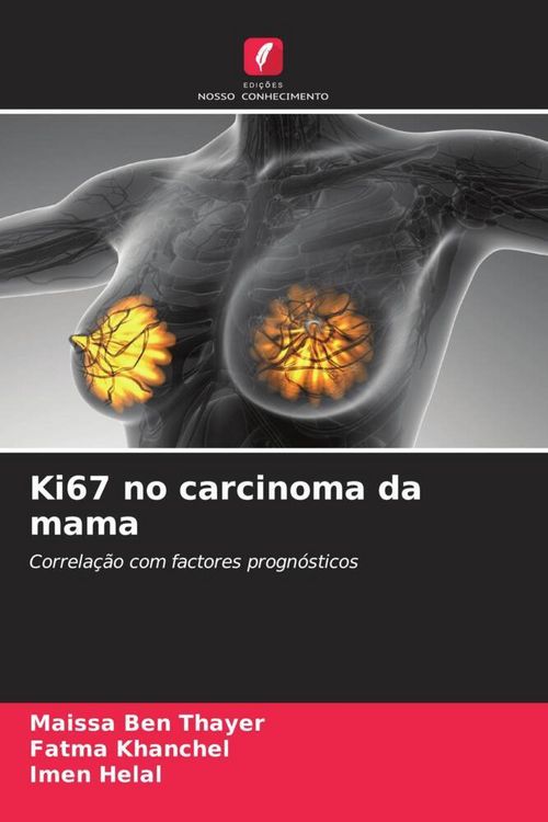 Produktbild: Ki67 no carcinoma da mama