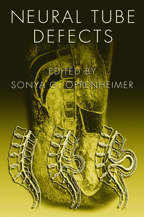 Produktbild: Neural Tube Defects