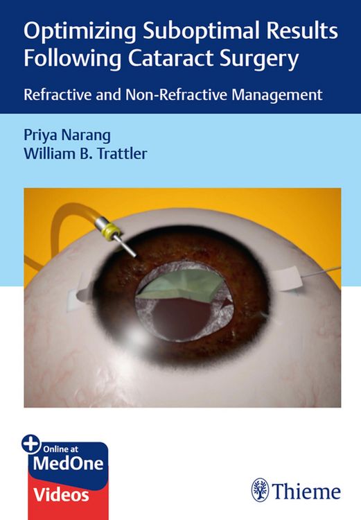 Produktbild: Optimizing Suboptimal Results Following Cataract Surgery
