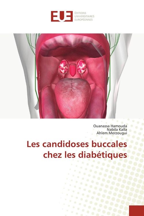 Produktbild: Les candidoses buccales chez les diab&eacute;tiques