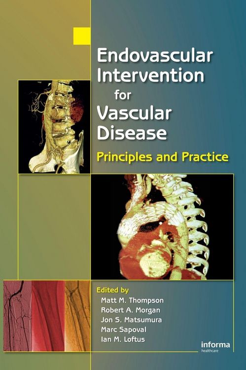 Produktbild: Endovascular Intervention for Vascular Disease
