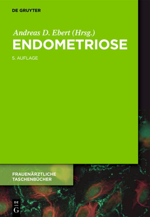 Produktbild: Endometriose