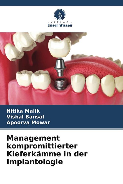 Produktbild: Management kompromittierter Kieferk&auml;mme in der Implantologie
