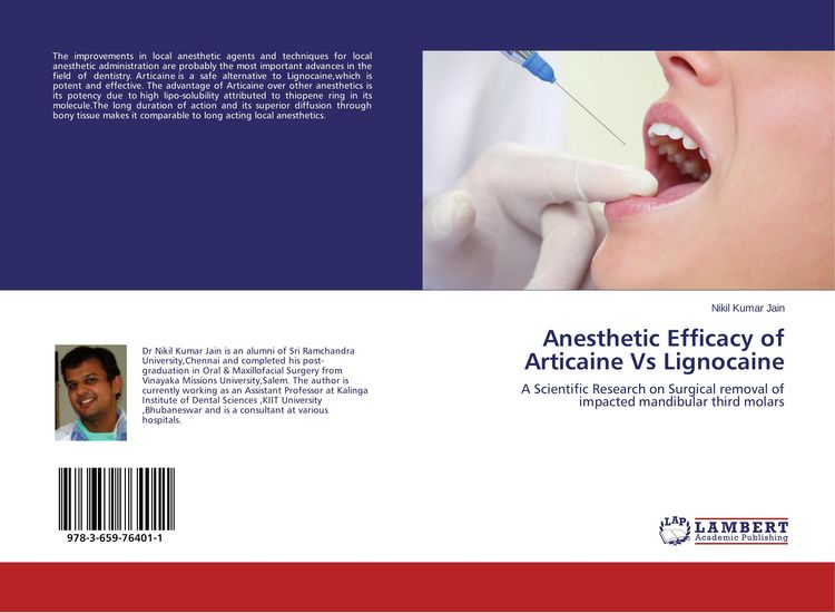 Produktbild: Anesthetic Efficacy of Articaine Vs Lignocaine