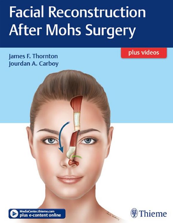 Produktbild: Facial Reconstruction After Mohs Surgery