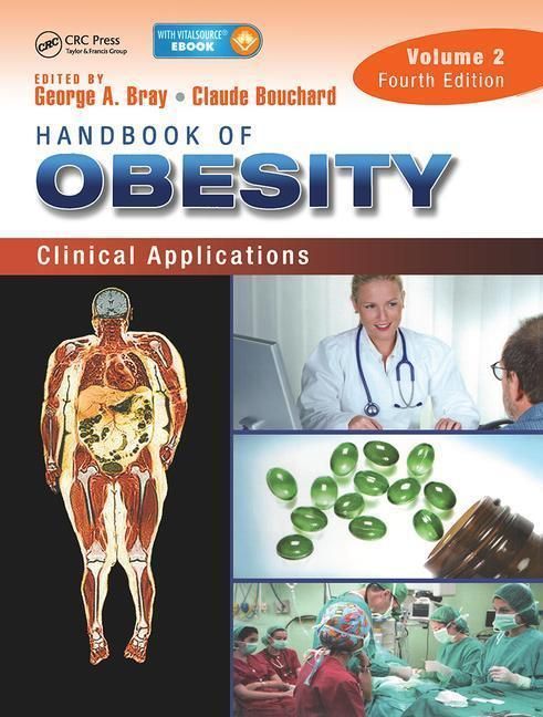 Produktbild: Bray, G: Handbook of Obesity - Volume 2