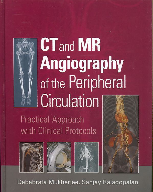 Produktbild: CT and MR Angiography of the Peripheral Circulation