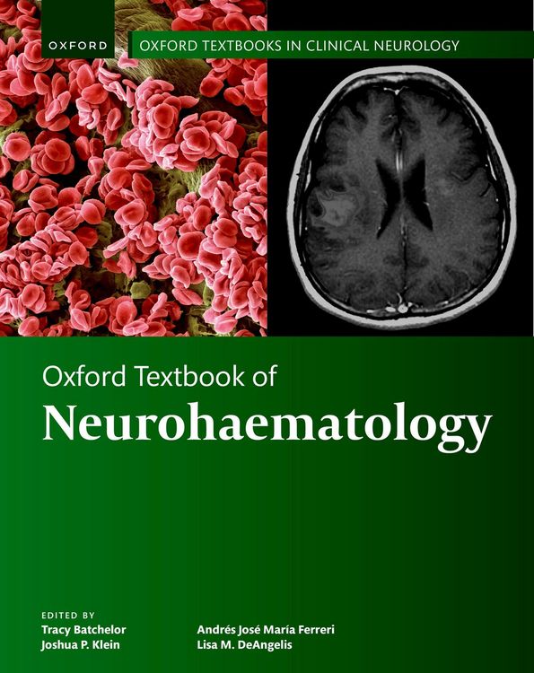 Produktbild: Oxford Textbook of Neurohaematology