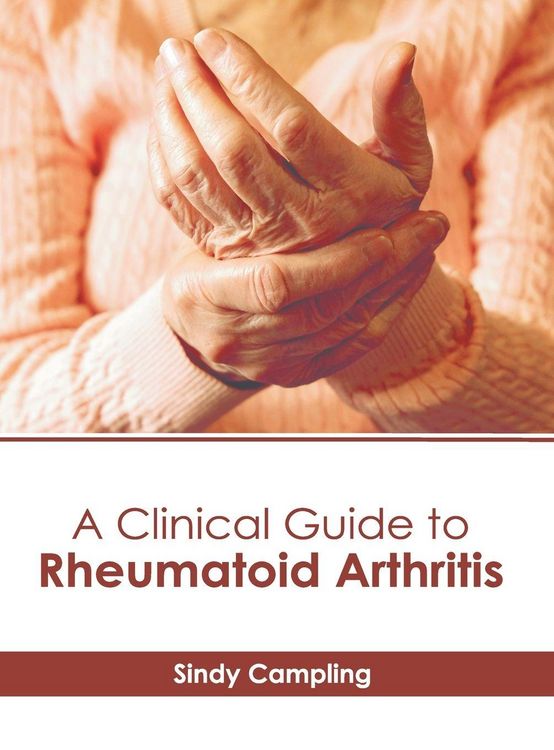 Produktbild: A Clinical Guide to Rheumatoid Arthritis